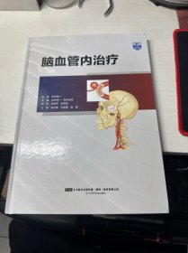 脑血管内治疗