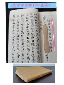 （中医文献）约80年代毛笔记录医书（共106筒子页）（祖传主治癌症神奇秘方 服药一个疗程，终身不得癌症，千真万确勿失良机）（主治半身不遂、风湿痹痛四肢麻木，关节扭伤，闪腰，岔气）（主治高血压病）（主治高血压病头晕头痛）（主治失眠）（主治肾虚阳痿遗精）（主治阳痿遗精，宫寒不孕）（主治牛皮癣）（主治身体痒风湿成颗成片）等内有大量偏方秘方（一册内容全）！！