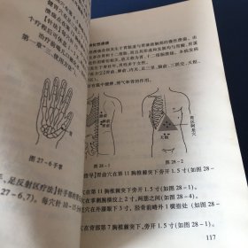 五行磁吸针磁疗针灸学