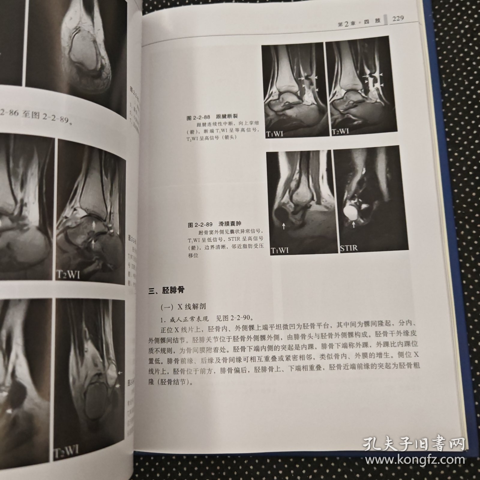 脊柱四肢影像图解：正常解剖-常见变异-常见病变