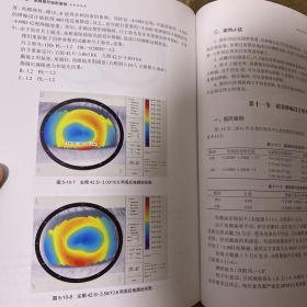 硬性角膜接触镜验配案例图解