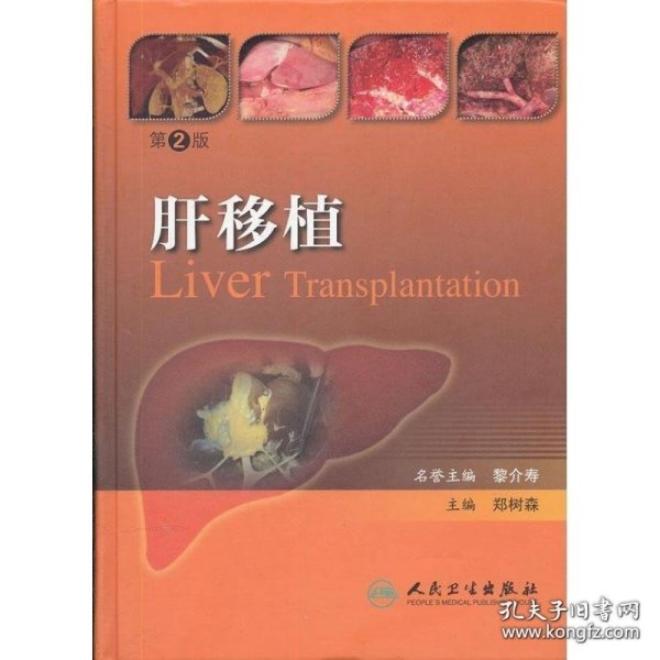 肝移植（第2版）