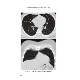 【正版新书】老年人新型冠状病毒Omicron感染胸部CT图谱