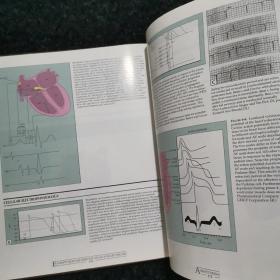 ESSENTIAL ATLAS OF HEART DISEASES