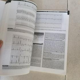 西氏内科学（第24版）：心血管疾病分册（英文影印版）