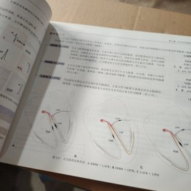 急诊心电图快速解读：心电图视觉记忆指南（W）