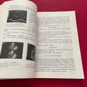 临床介入性超声学