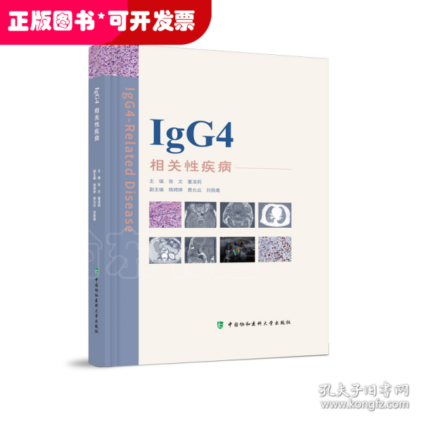 IgG4相关性疾病