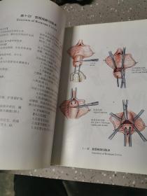 妇产科手术彩色图谱