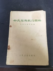 针灸临床取穴图解