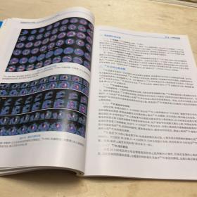 影像核医学与分子影像（第3版 配增值）