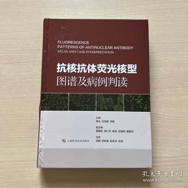 抗核抗体荧光核型图谱及病例判读