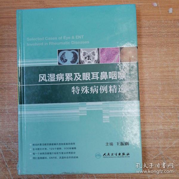 风湿病累及眼耳鼻咽喉特殊病例精选