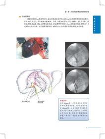 新华正版 肝胆胰外科手术实录（翻译版） 唐伟 著 9787117288170 人民卫生出版社