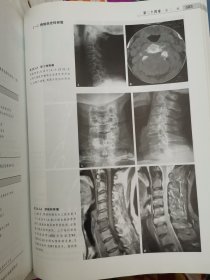 骨与软组织肿瘤影像诊断学：部位特性、诊断与鉴别【精装 馆藏】见描述