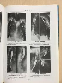临床X线诊断学图谱  腹部分册