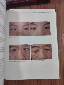 眼整形美容外科图谱