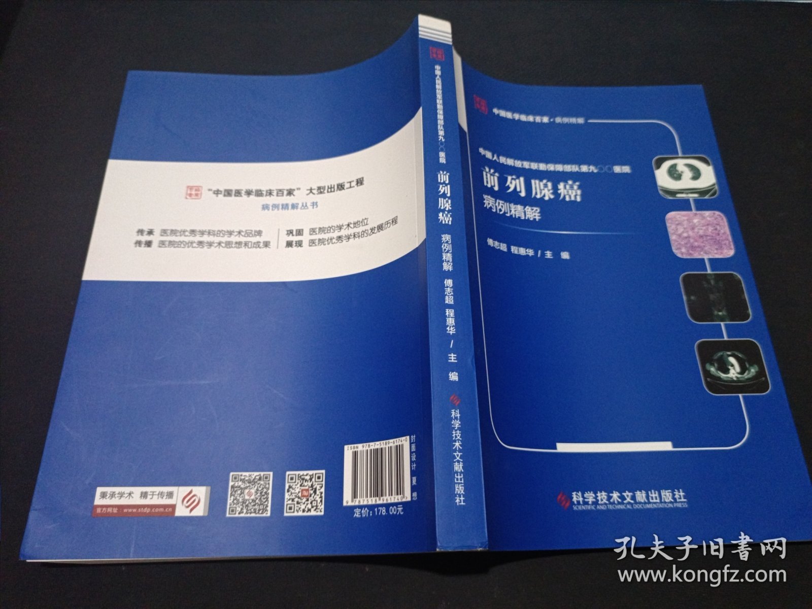 中国人民解放军联勤保障部队第九〇〇医院前列腺癌病例精解