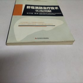 肝癌消融治疗技术实战图解