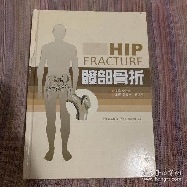 髋部骨折