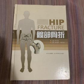 髋部骨折