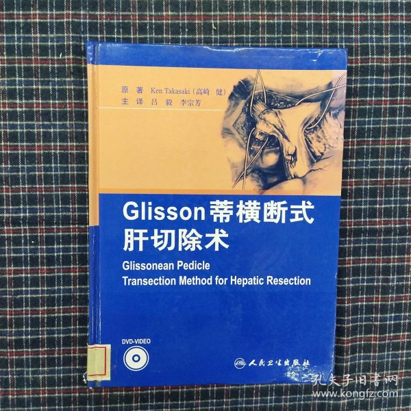 Glisson蒂横断式肝切除术