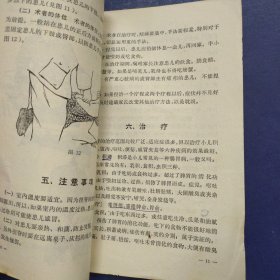 小儿捏脊