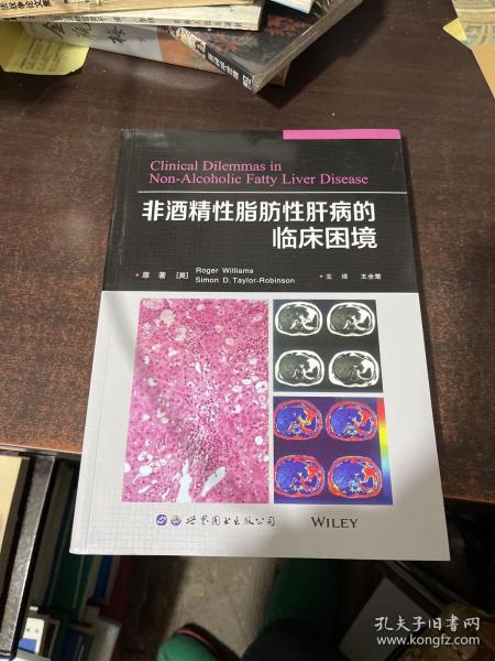 非酒精性脂肪性肝病的临床困境