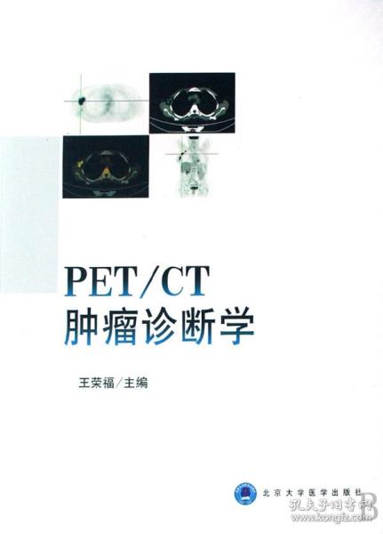 PET/CT肿瘤诊断学