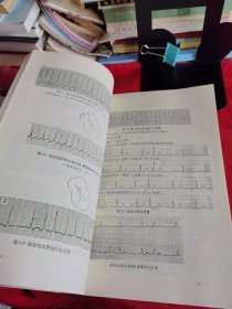 《临床心电图诊断手册》【正版现货，品如图所有图片都是实物拍摄】