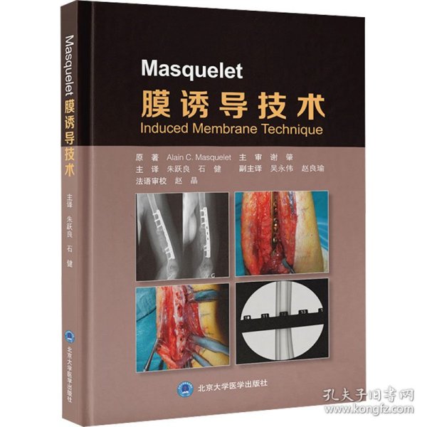 Masquelet 膜诱导技术