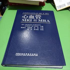 心血管MRI和MRA