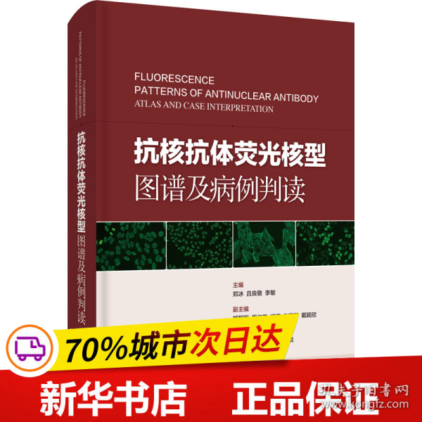 抗核抗体荧光核型图谱及病例判读