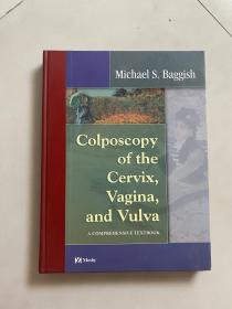 Colposcopy of the Cervix, Vagina, and Vulva: A Comprehensive Textbook-宫颈、阴道和外阴阴道镜检查：综合教材