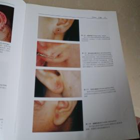 耳鼻咽喉科学彩色图谱