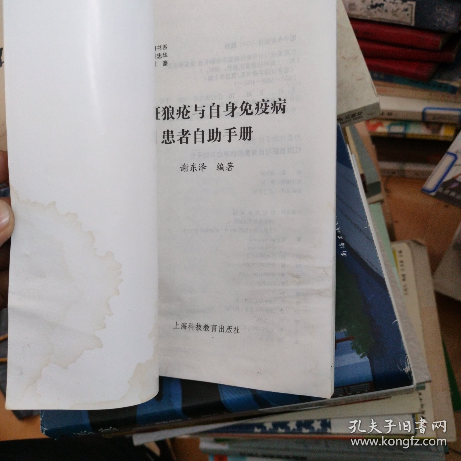 红斑狼疮与自身免疫病患者自助手册