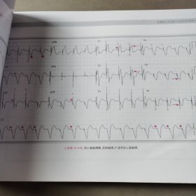 波德瑞德（Podrid）临床心电图解析（卷6）:起搏心律、遗传性心律失常、电解质紊乱及其他