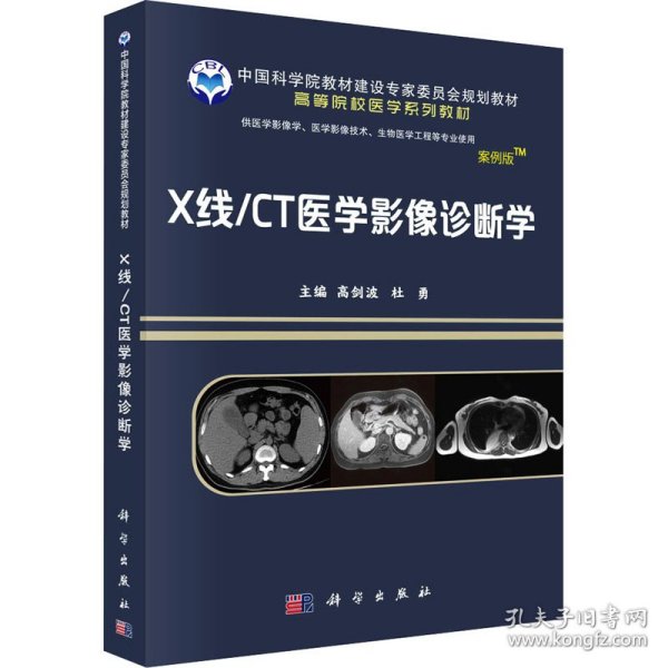 X线/CT医学影像诊断学