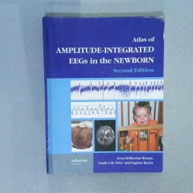 atlas of amplitude integrated eegs in the newborn 新生儿振幅脑电图集