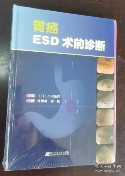 胃癌ESD术前诊断