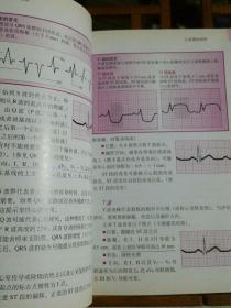 疑难心电图快速诊断与分析