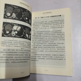 肝癌消融治疗技术实战图解