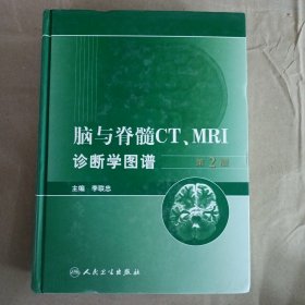 脑与脊髓CT、MRI诊断学图谱（第2版）