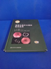 微探头超声内镜的临床应用