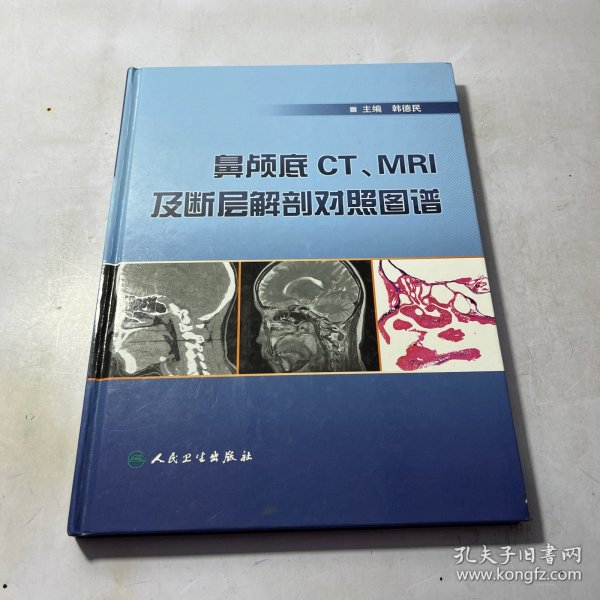 鼻颅底CT、MRI及断层解剖对照图谱