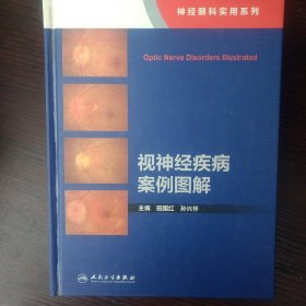 视神经疾病案例图解（神经眼科实用系列）