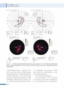 Ryan视网膜学(原书第6版)