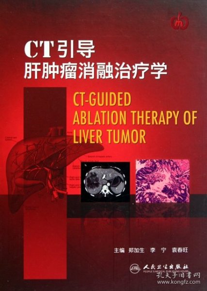 CT引导肝肿瘤消融治疗学（精）