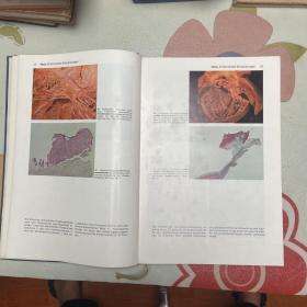 Atlas der pathologischen Anatomie病理解剖图谱(品自鉴）