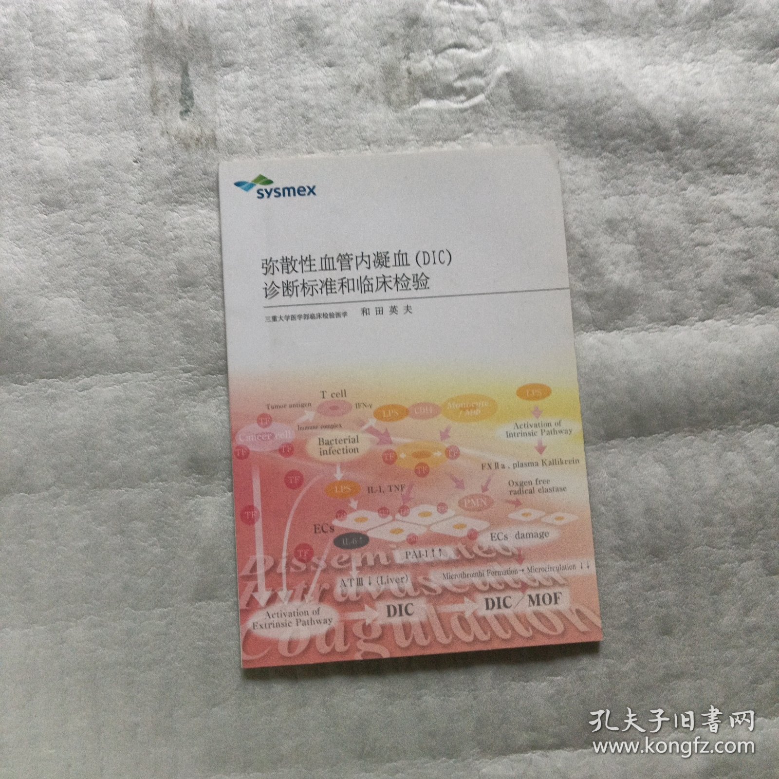 弥散性血管内凝血（DIC）诊断标准和临床检验